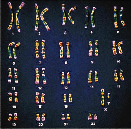 Caryotype d'un humain de sexe masculin